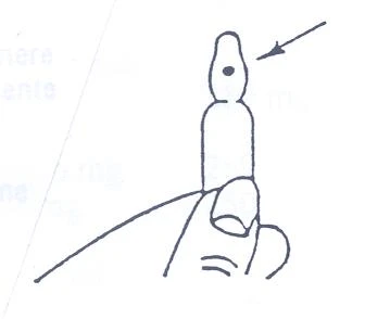 Disegno schematico di un dito che indica un piccolo punto scuro sulla punta di un dispositivo medico allungato con una freccia direzionale