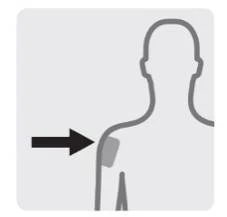 Diagramma stilizzato di un busto umano con una freccia nera che punta verso la parte superiore del braccio destro per indicare il sito di iniezione