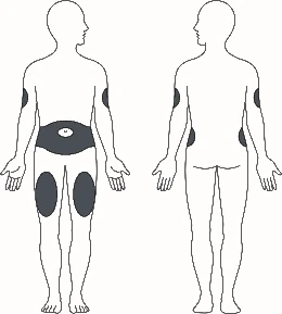 Diagramma di due figure umane stilizzate, una frontale e una di schiena, con aree scure su braccia, addome e cosce per indicare i siti di iniezione