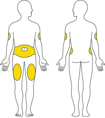 Diagramma di due sagome umane frontale e posteriore con aree gialle che indicano i siti di applicazione su addome, cosce, braccia e fianchi