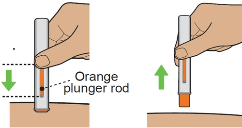 Two illustrations showing a hand pressing a medical device with a