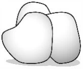 Stylized black-and-white drawing of three rounded, irregular shapes resembling lobes or organic tissues placed adjacent to each other