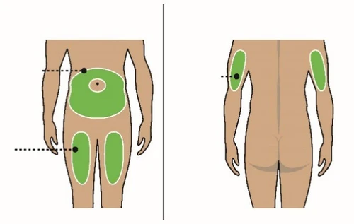 Diagram of the human body showing green areas for the