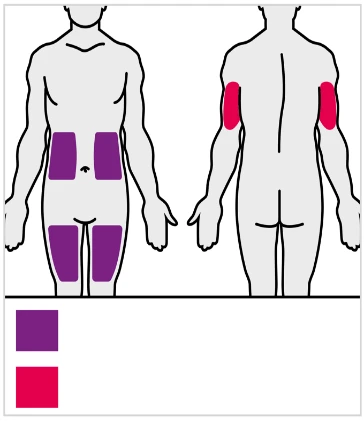 Front and back human body diagram with purple areas on the