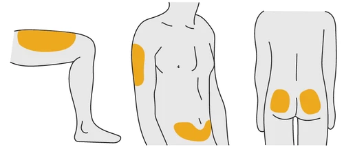 Schematic diagrams of a human body indicating drug application sites on the thigh and hip