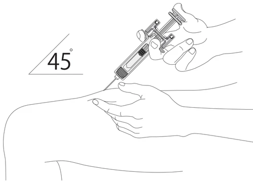 Disegno tecnico che mostra una mano che impugna una siringa per iniettare un farmaco in una gamba con un angolo di 45 gradi