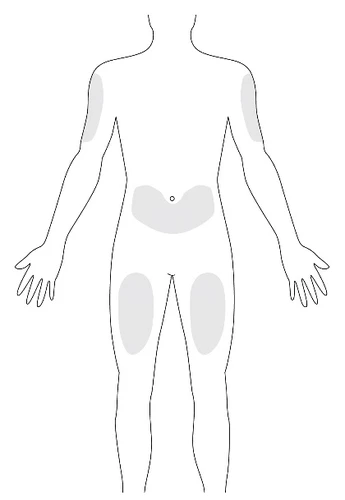 Schema del corpo umano stilizzato con aree grigie evidenziate sulle spalle, sull'addome e sulle cosce per indicare zone di applicazione o dolore
