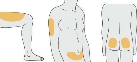 Schematic diagrams of a human body showing orange-colored areas on arm, abdomen, buttocks, and thigh to indicate injection sites