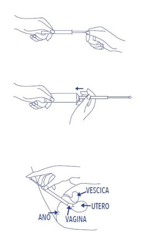 Trzy ilustracje pokazują ręce przygotowujące strzykawkę i