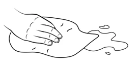 Line drawing of a hand firmly pressing on a cloth or gauze placed over an uneven surface