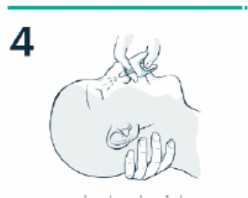 Medical illustration showing a hand applying a device to the upper part of the nose of a lying person with the