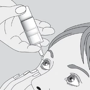 Black and white drawing showing a hand holding a dropper bottle to administer eye drops into the eye