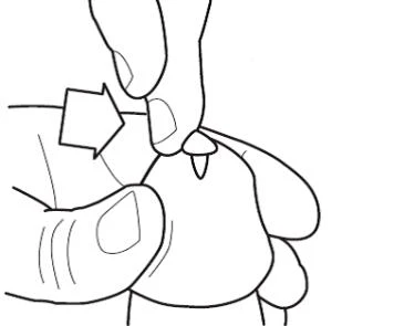 Dibujo en blanco y negro que muestra una mano que pellizca la piel del brazo mientras la