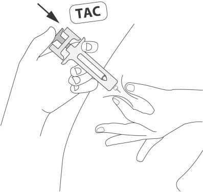 Una mano impugna un dispositivo medico TAC per un'iniezione mentre l'altra mano tesa sostiene la pelle del paziente nel punto di applicazione