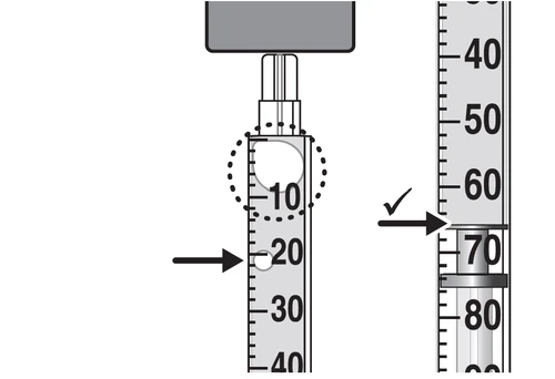 Diagram showing the liquid level in a syringe with an arrow indicating the 20 ml mark on the left and a checkmark at 70 ml on the right