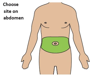 Drawing of a male torso with a