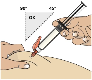 Medical illustration showing a hand inserting a needle with syringe into the gluteal muscle at the correct angle of 45 or 90 degrees