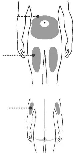 Diagramma del corpo umano che indica le zone di iniezione sull'addome, sulle cosce e sui glutei tramite linee tratteggiate e aree grigie