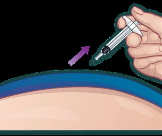 A hand holding a syringe with a needle directed toward the skin of the