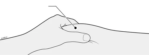 Line drawing showing a hand pressing with the thumb on the skin surface at a point marked by a black dot and a line