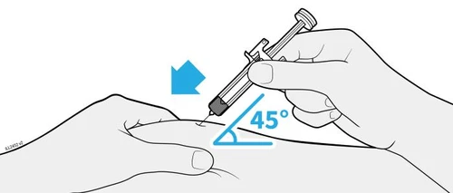 A hand holds a syringe injecting medication into the skin at a 45-degree angle indicated by a blue arrow and a graphic symbol
