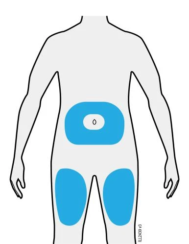 Stylized diagram of a human body with blue highlighted areas on the torso