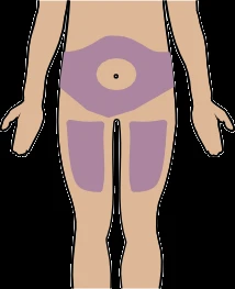 Diagramma del corpo umano che mostra aree colorate in viola sull'addome e sulle cosce per indicare i siti di applicazione del farmaco
