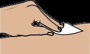 Una mano tiene un tampone bianco e lo strofina sulla superficie della pelle per la disinfezione della zona prima di un trattamento medico