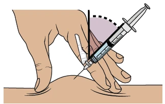 Una mano tiene una siringa inclinata a 45 gradi mentre inserisce l'ago nella pelle del corpo con una linea tratteggiata che indica l'angolo