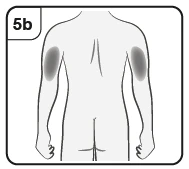 Schematic drawing of a man's back with two circular gray areas indicating application points on the upper arms