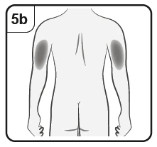 Schematic of the human torso viewed from the back with two oval gray areas positioned on the outer upper part of both arms