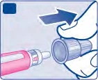 Ilustración médica que muestra una mano que desplaza un tapón hacia afuera