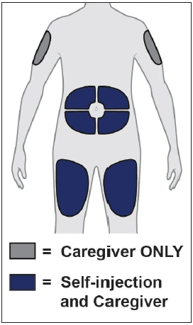 Human body diagram showing gray areas on the arms for caregiver and blue areas on the abdomen and thighs for self-injection or caregiver administration