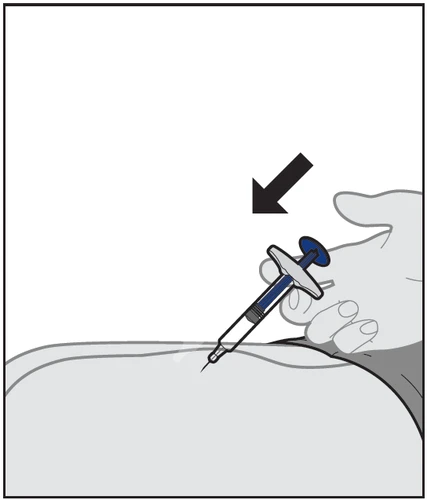 A hand holds a syringe with blue liquid inserting it vertically into the upper thigh or gluteal area with a black indicator arrow