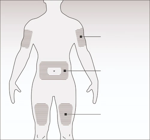 Schema del corpo umano con zone tratteggiate su braccia, addome e cosce che indicano i siti di applicazione del farmaco con linee di riferimento