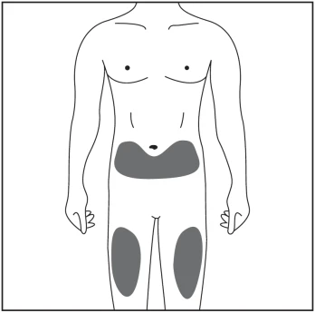Schematic representation of the male human body with gray highlighted areas on the