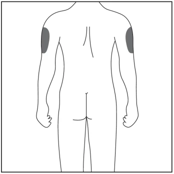 Schematic drawing of the back of a human body with two gray highlighted areas on the outer upper part of both arms