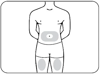 Schematic drawing of a human torso with highlighted gray areas on the