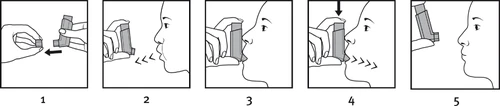 Cinco pasos esquemáticos para usar el inhalador: separar el dispositivo, acercarlo a la boca, inhalar, presionar el dosificador y retirar el inhalador