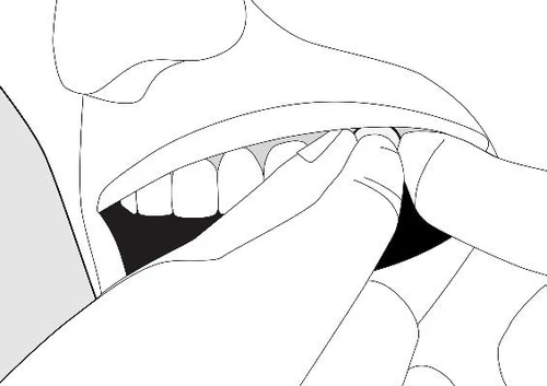 Primer plano de la boca y los dientes de una persona cuyos dedos apartan suavemente el labio para revelar la cavidad bucal y las encías
