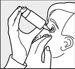 Hands holding a white bottle with eye drops, administering medication directly into the eye of a person tilting their head backward and gently pulling down the eyelid