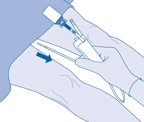 Mano con guanto blu che tiene un iniettore bianco, puntandolo verso la coscia, con una freccia scura che indica la direzione dell'applicazione del farmaco