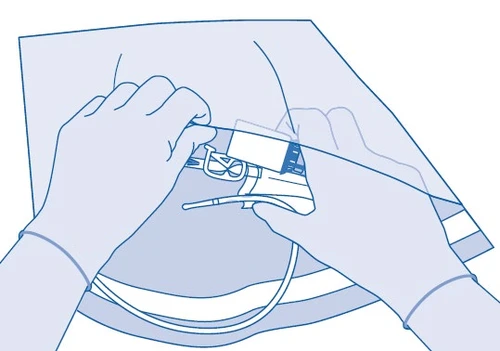 Due mani con guanti blu che tengono e preparano un dispositivo medico bianco con un sottile tubo e un elemento di fissaggio