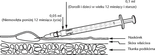 Injection administration diagram: dose of 0.05 ml for infants under 12 months and 0.1 ml for older individuals, needle entering the epidermis and dermis