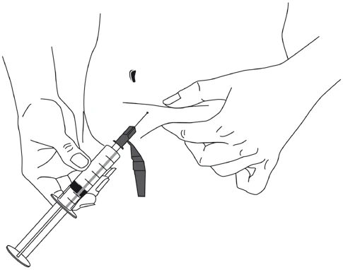 Hands preparing the injection site on the abdomen, holding a syringe with the needle directed toward the stretched abdominal skin