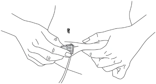 Two hands holding and pressing a small, rectangular applicator with a thin tube against the abdominal skin for medication delivery