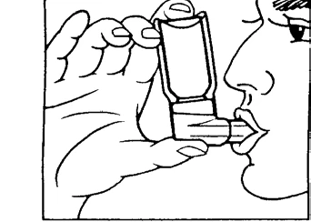 Illustration showing a hand holding an inhaler at the mouth of a person ready to receive medication via inhalation through the device's mouthpiece