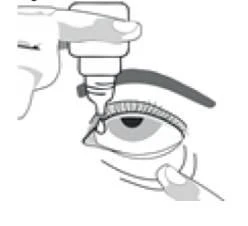 Hand holding a small bottle of eye drops at an angle above an open eye, while the other hand gently pulls down the lower eyelid