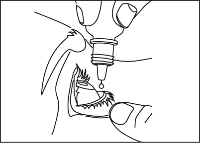 Hand holding a small bottle with a dropper, from which a single drop of medication falls directly into an open eye showing visible eyelashes