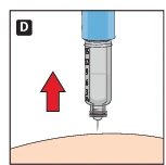 A vertical syringe with a visible millimeter scale; a red arrow pointing upward indicates plunger movement above the patient's skin